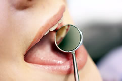 Cavity Prevention is Key