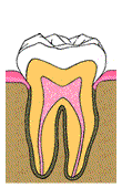 root canal diagram